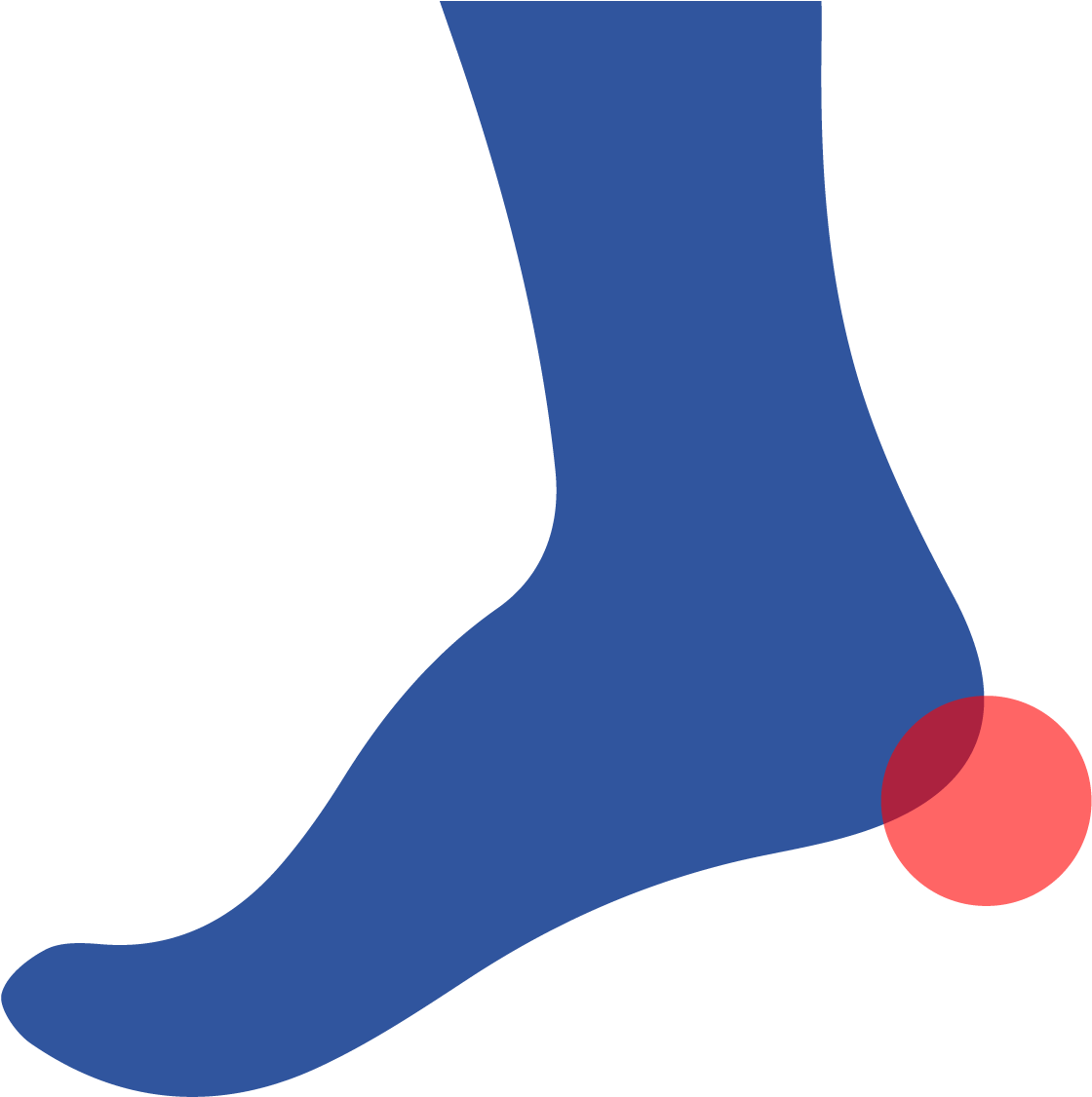 A Heel Spur Is A Calcium Deposit That Forms A Small - Sock Clipart (1667x1667), Png Download