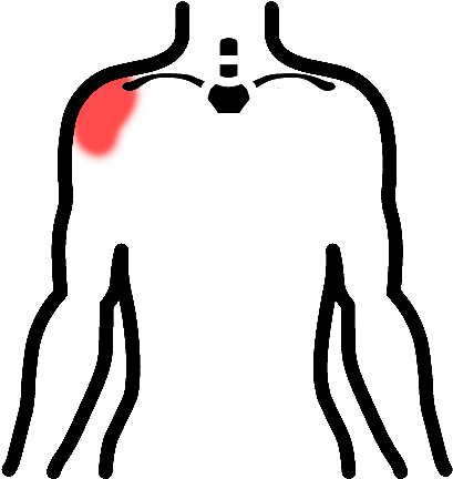 Biceps Tendinosis Clipart (601x667), Png Download