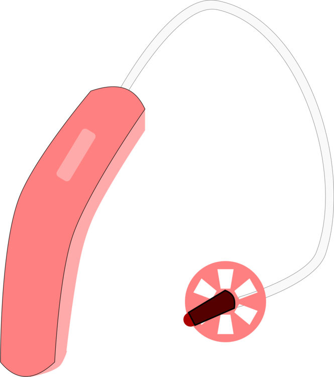 Hearing Aid Hearing Loss Hearing Test Deafness - Hearing Loss Clipart (665x750), Png Download