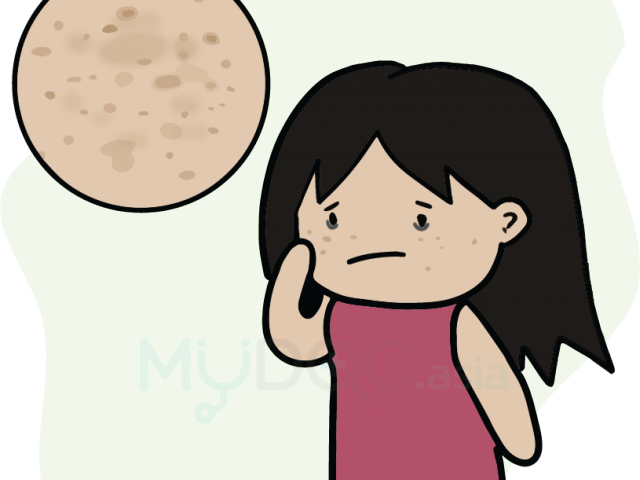 Eye Patch Clipart Translucent - Cartoon - Png Download (640x480), Png Download