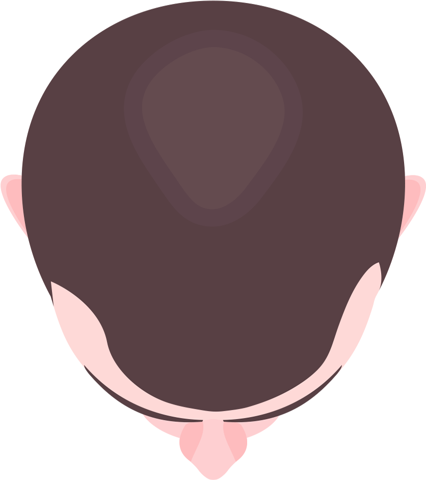 Touch Ups - Circle Clipart (886x993), Png Download