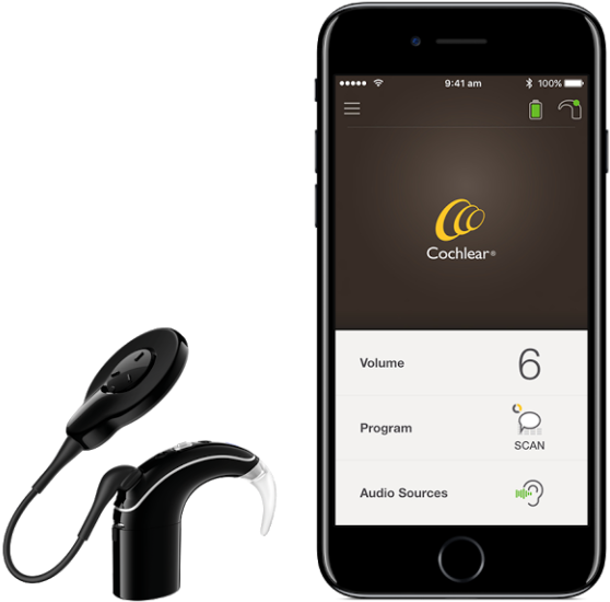 Lanzan Primer Implante Auditivo Compatible Con - Cochlear App Clipart (640x655), Png Download