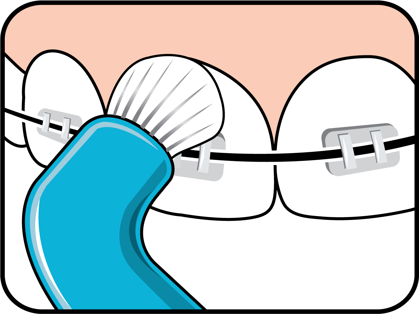Effective Cleaning Along The Gum Line Clipart (1500x1500), Png Download