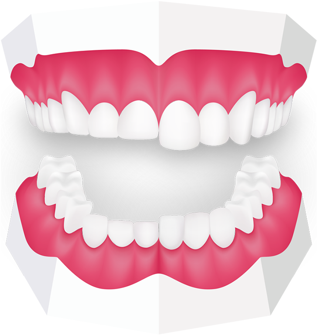 Tooth Grinding Toothbeary - Teeth Grinding Png Clipart (700x693), Png Download