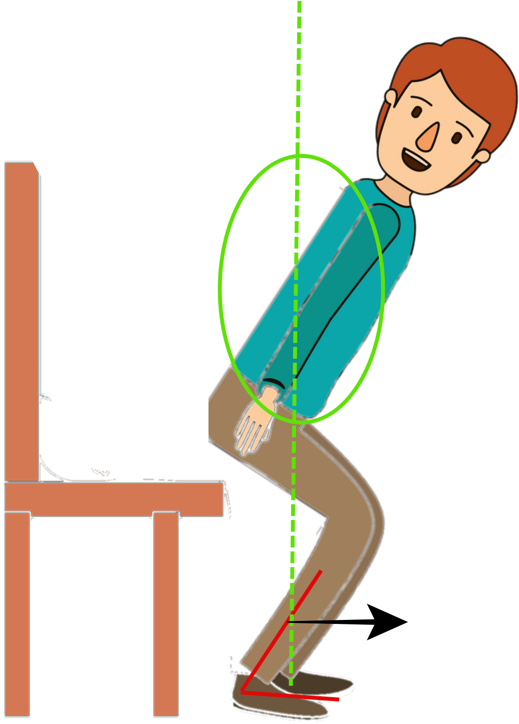 What Causes Drop Foot And What Are The Best Exercises Cartoon Clipart