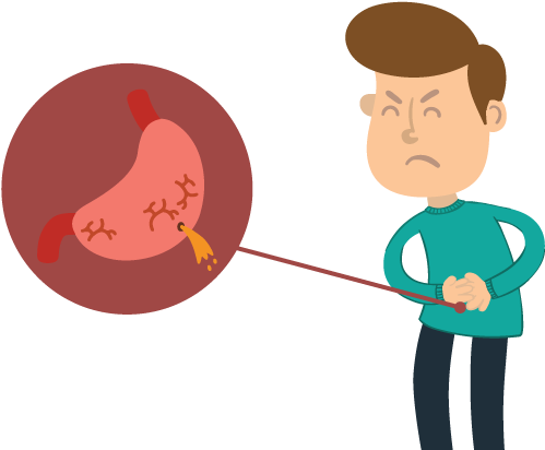 Gastric Ulcer - Cartoon Clipart (842x500), Png Download