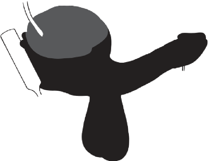 Possible Sites Of Collection Of Sperm Or Elongated Clipart (696x539), Png Download