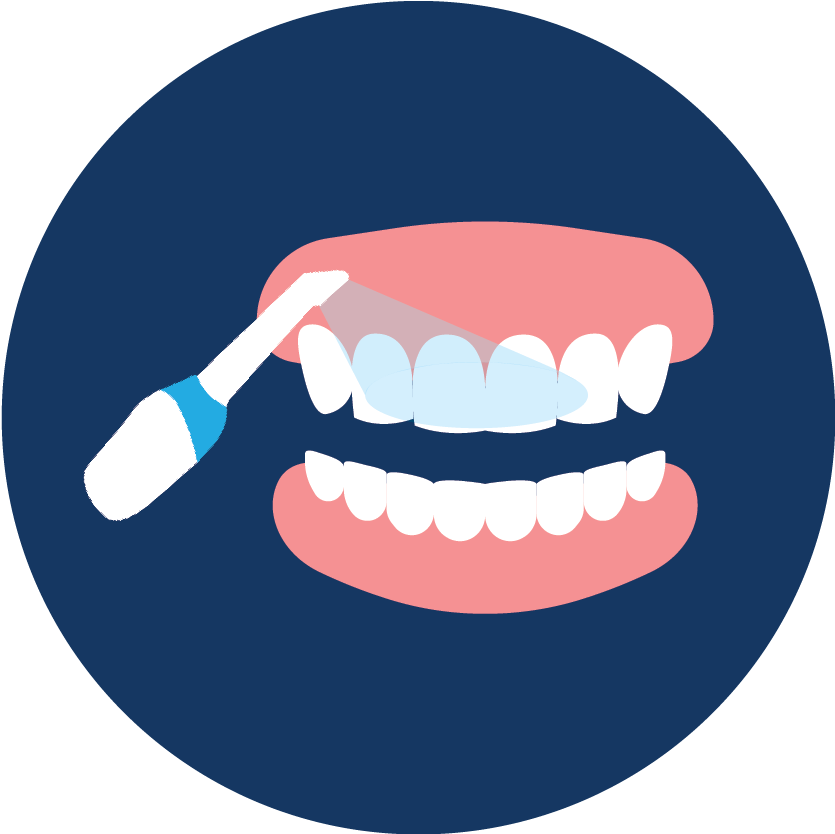 Intraoral Scanning Clipart (891x833), Png Download