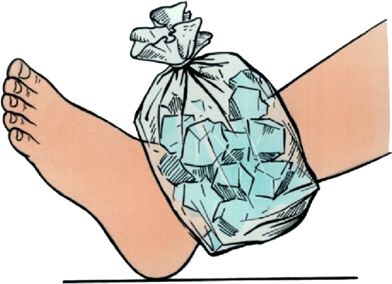 Icing Helps - Ice On Ankle Clipart - Png Download (850x576), Png Download