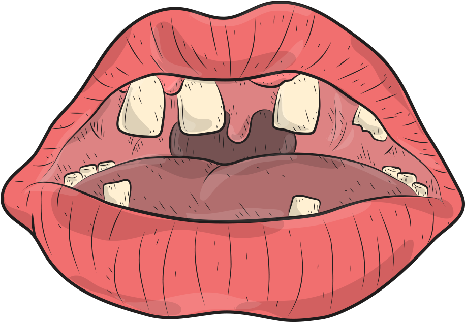 Tieri Wince , Ugo Zamponi ( Motion ) - Nrh2o Clipart (1080x1080), Png Download