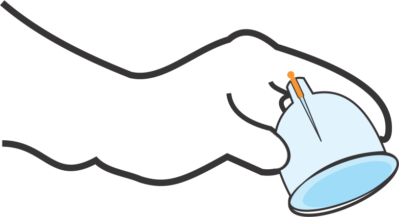 Cupped Clipart Cuo - Hijama Cupping Clip Art - Png Download (783x427), Png Download