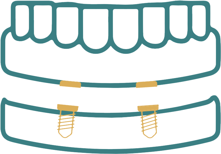 Full Mouth Rehabilitation Png Clipart (755x755), Png Download