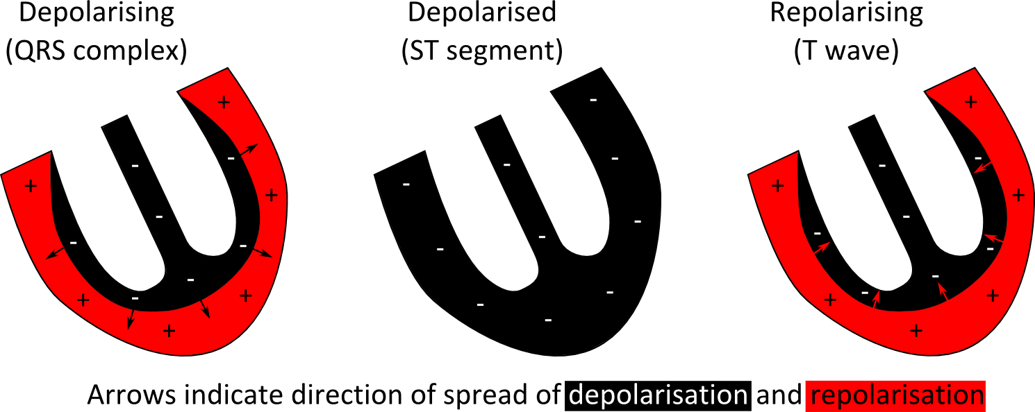 Royalty Free Stock Natalies Casebook Tag Figure The - T Wave Upward Deflection Clipart (1490x594), Png Download