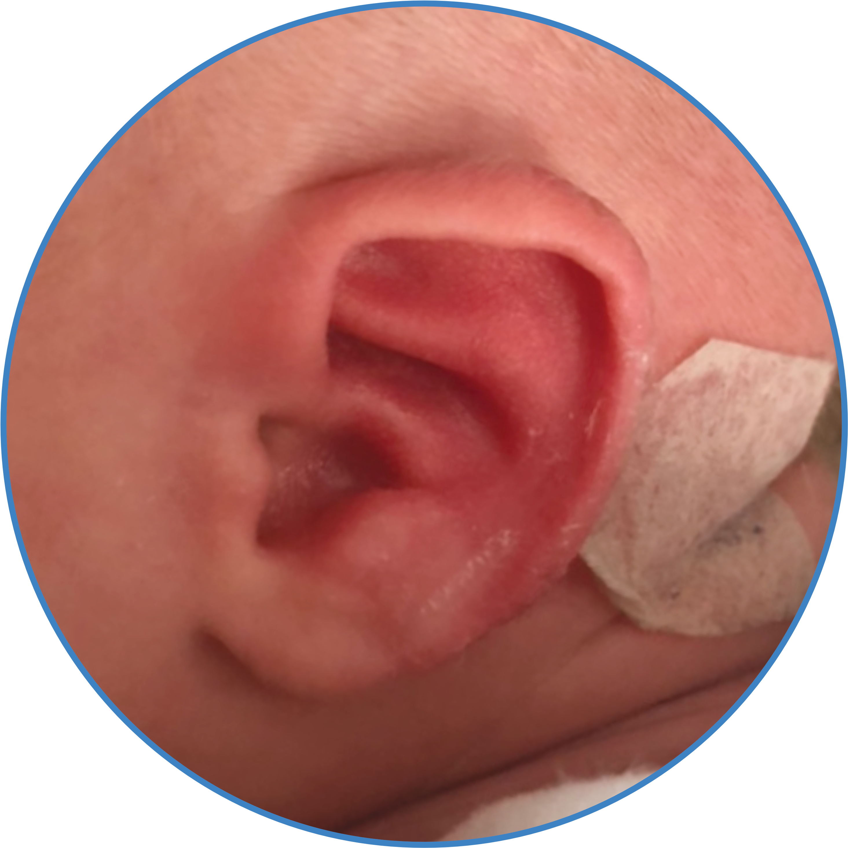 Earbuddies Reviews Results Parents Ear Of The Month - Icc Clipart (3000x3000), Png Download
