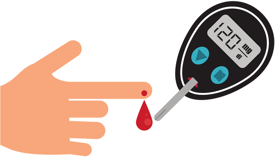 Cystic Fibrosis Often Affects A Person's Digestive - Illustration Clipart (940x788), Png Download