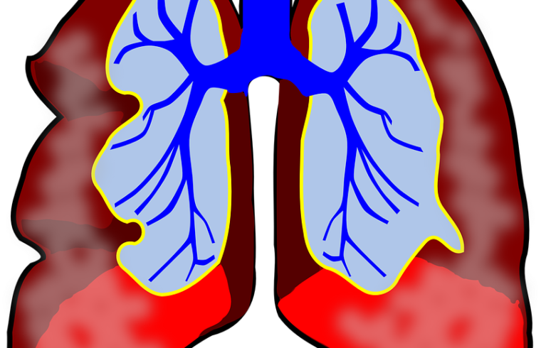 Fighting Fungous Respiratory Organ Infections With - Lungs Clip Art - Png Download (760x490), Png Download