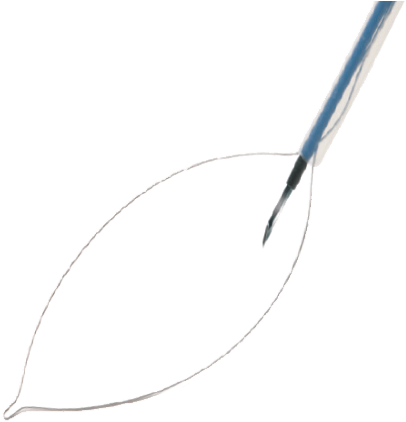 Polypectomy Snares - Sketch Clipart (671x579), Png Download