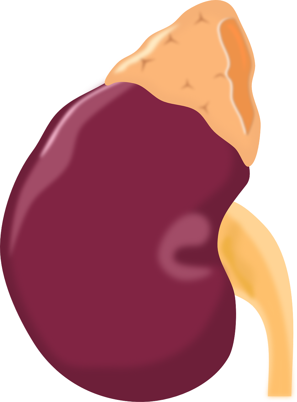 Kidney Disease Or Failure - Kidney .png Clipart (946x1280), Png Download
