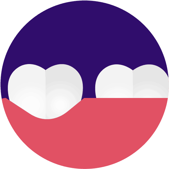 Two Teeth With Receding Gums Graphic - Circle Clipart (626x626), Png Download