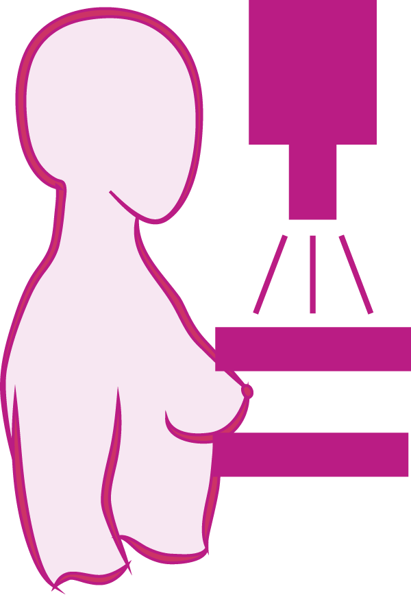 Needle Clipart Biopsy - Triple Assessment Breast Cancer - Png Download (600x868), Png Download