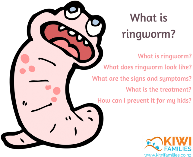 Worms Clipart Ringworm - Ringworm Nz - Png Download (645x541), Png Download