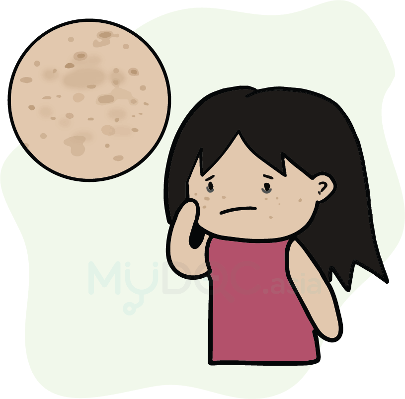 Juliet Station Pigmentation - Smiley Face Clipart (815x803), Png Download