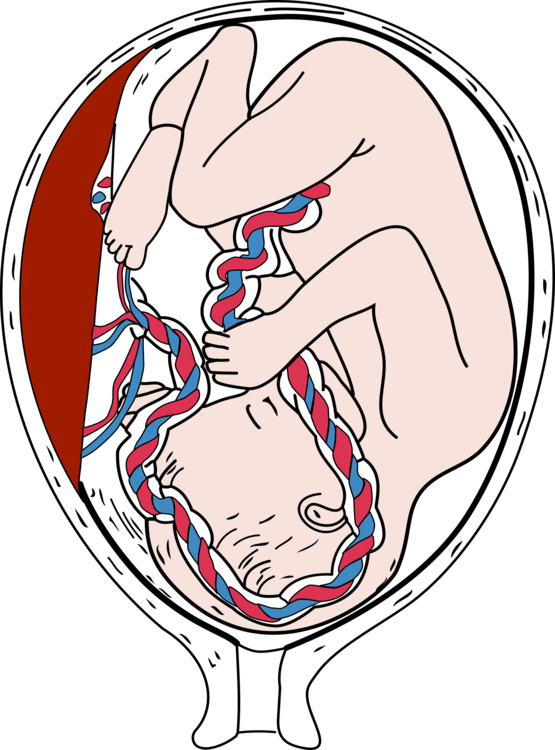 Emotion,art,human - Placenta Png Clipart (555x750), Png Download