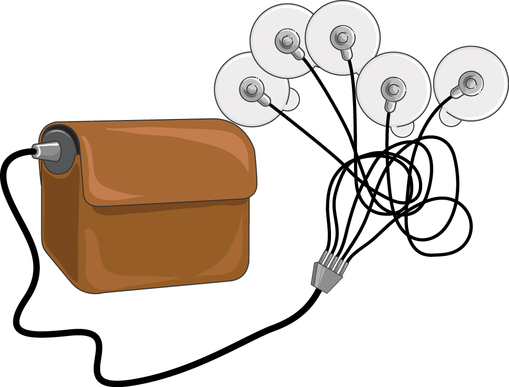 Monitor Holter Clipart (995x758), Png Download