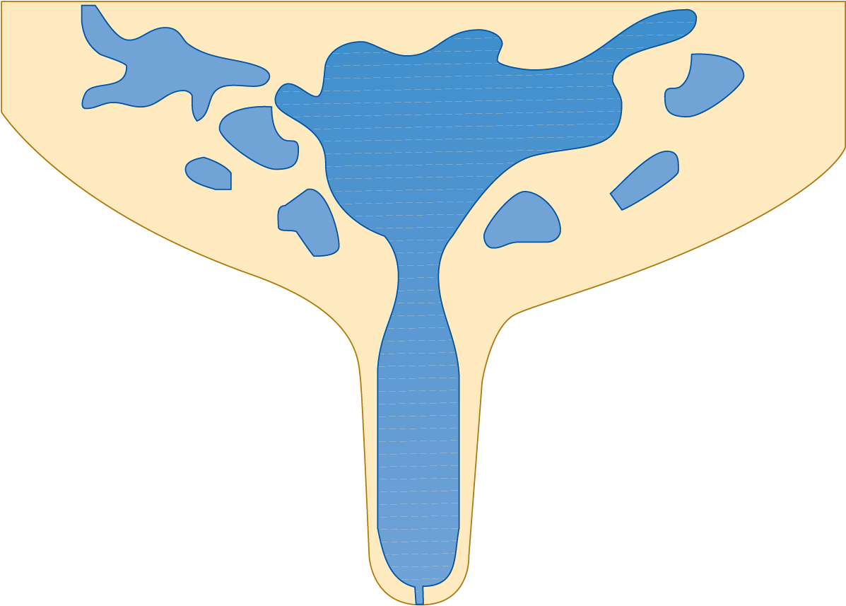 Clip Art - Png Download (1200x867), Png Download