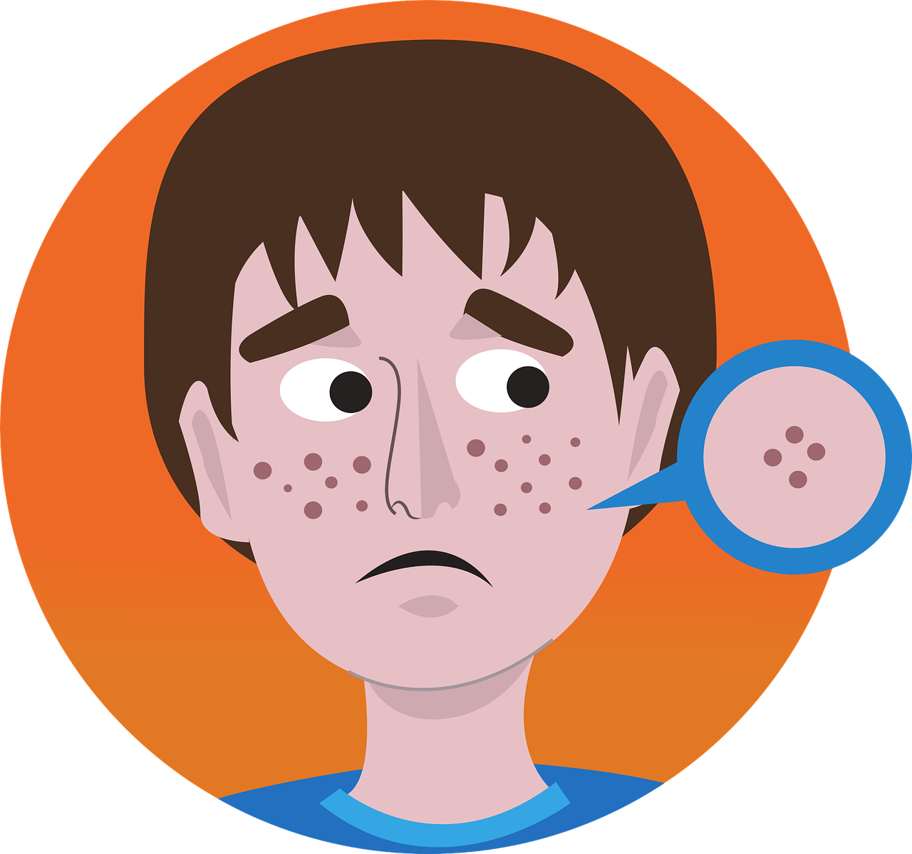 Acne Graphic Clipart (1280x1199), Png Download