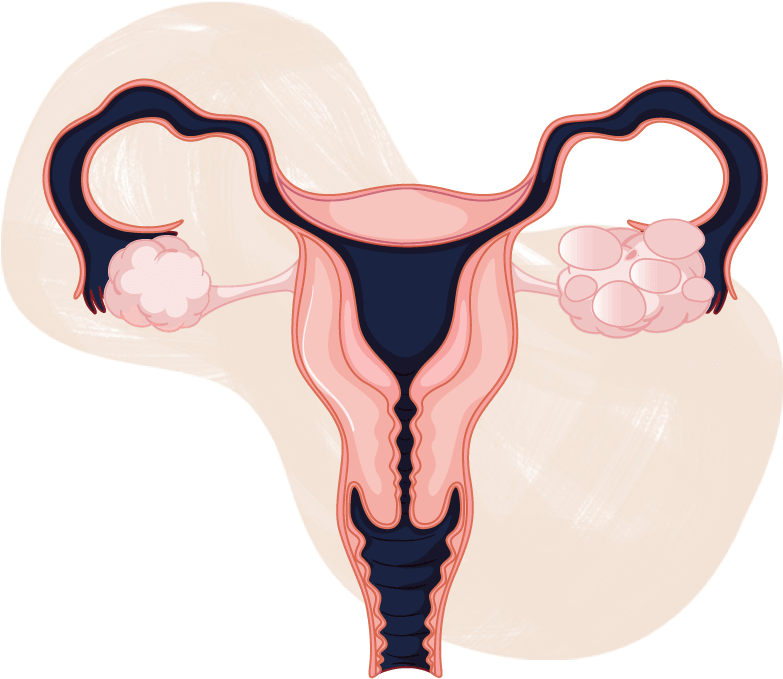 Pcos And Pregnancy - Female Reproductive System Cartoon Clipart (825x825), Png Download