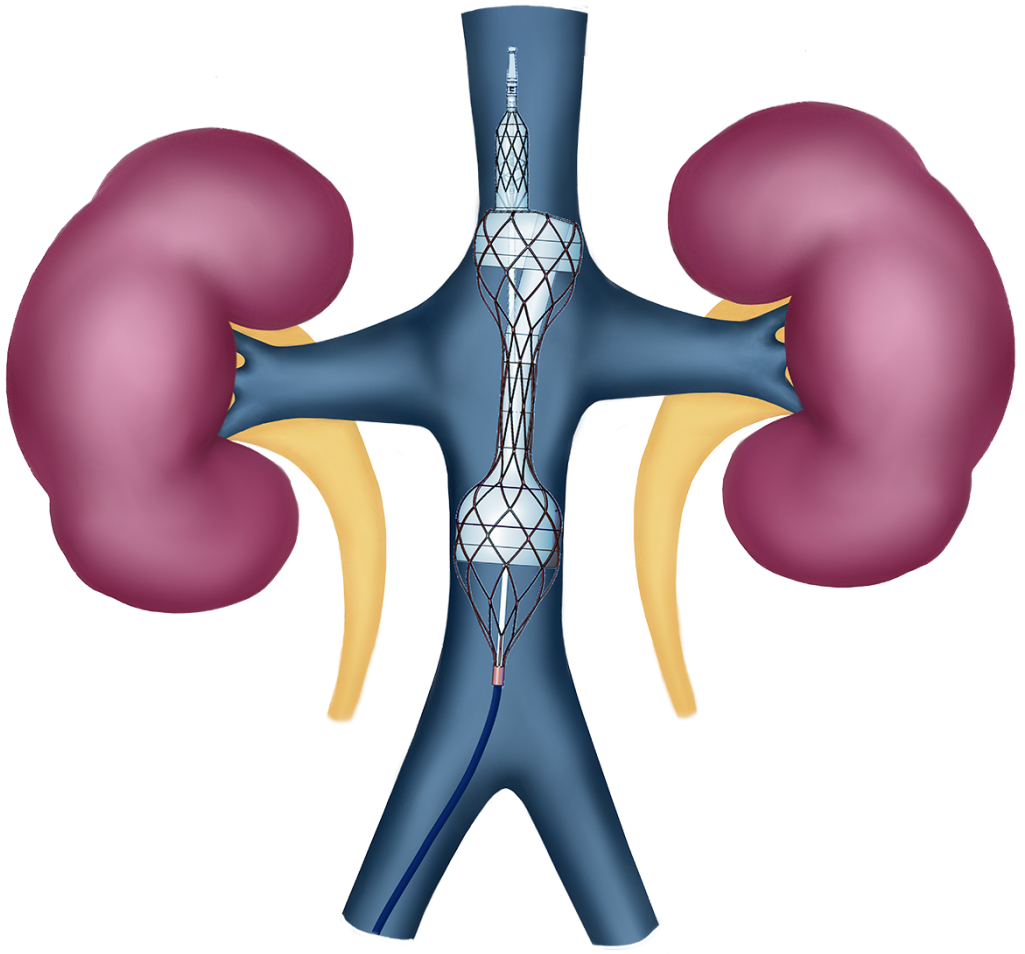 Illustration Clipart (1024x960), Png Download