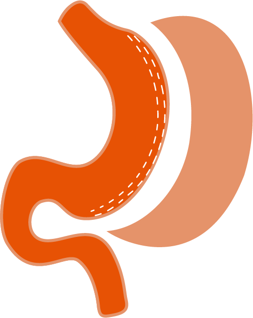 Laparoscopic Sleeve Gastrectomy Logo Clipart (518x651), Png Download