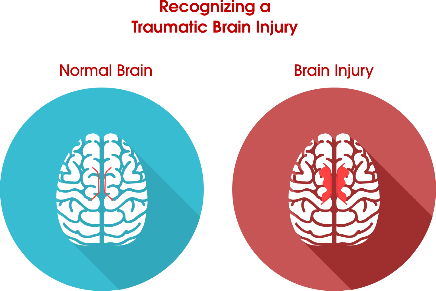 Tell If You Have Brain Damage Clipart (1442x964), Png Download