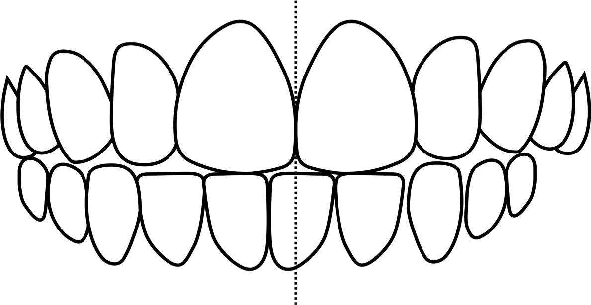 Crooked Teeth - Brasilia Tv Tower Clipart (1200x622), Png Download