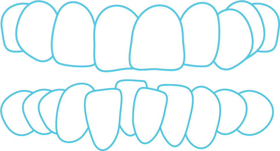 Crowding - Circle Clipart (1200x602), Png Download