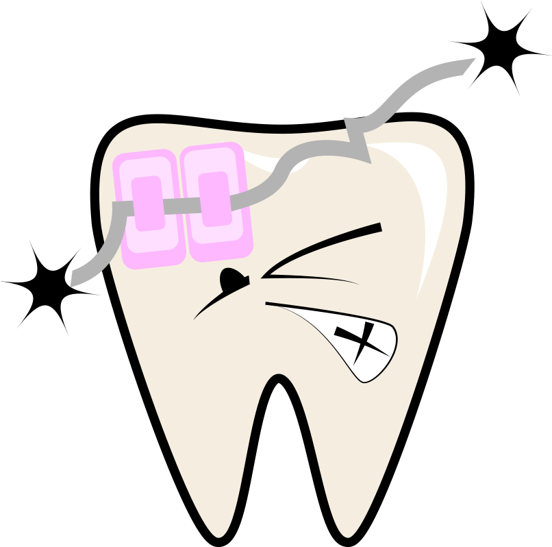 Braces-retainers Clipart (900x900), Png Download