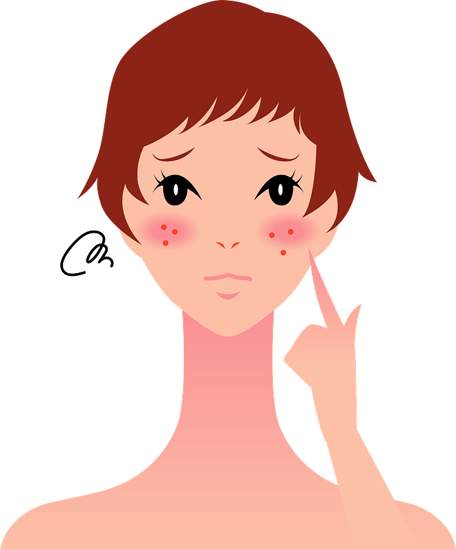 Woman Girl Skin Diseases Clipart - Acne - Png Download (665x800), Png Download