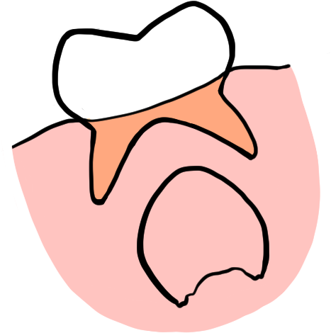 Clip Art - Png Download (619x597), Png Download