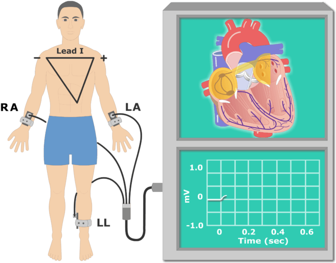 The P Wave Ekg Recording Animation Slide - Ecg Cartoon Clipart (666x550), Png Download