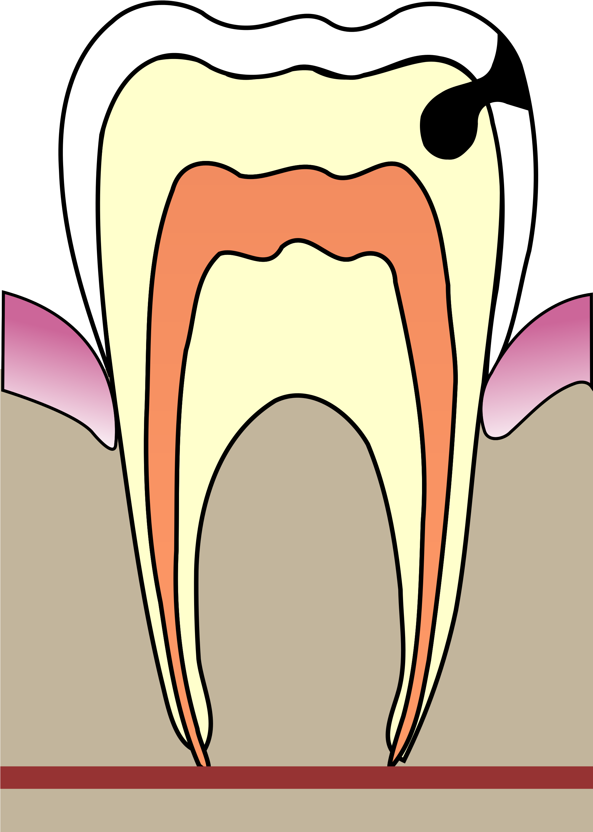 Open - Cavities Clipart (2000x3018), Png Download