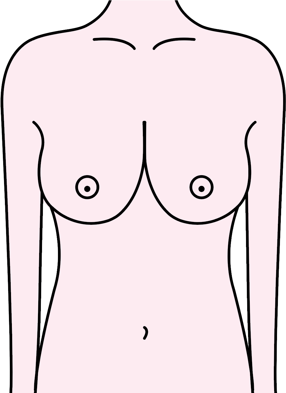 This Is The Opposite Of Wide Set, This Is Where The - Cartoon Clipart (1336x1354), Png Download