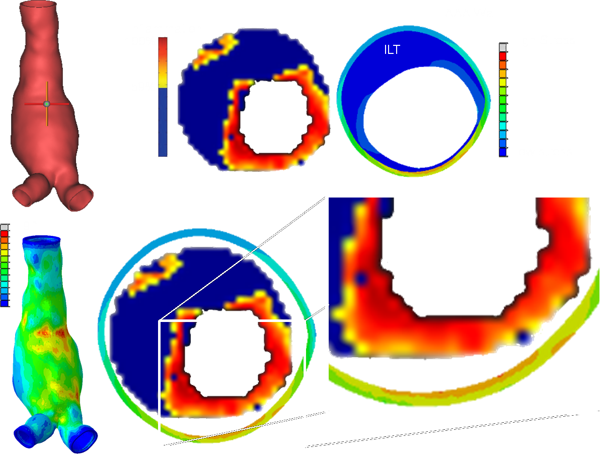 And Strains In The Vascular Tissue, Whereas With Computational - Circle Clipart (1198x901), Png Download