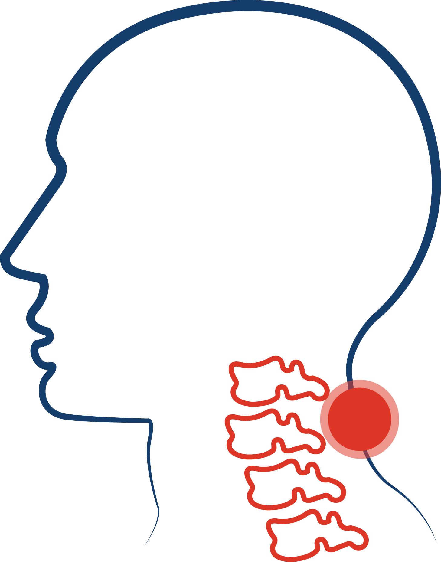 Cervical Spinal Stenosis Clipart (1458x1858), Png Download