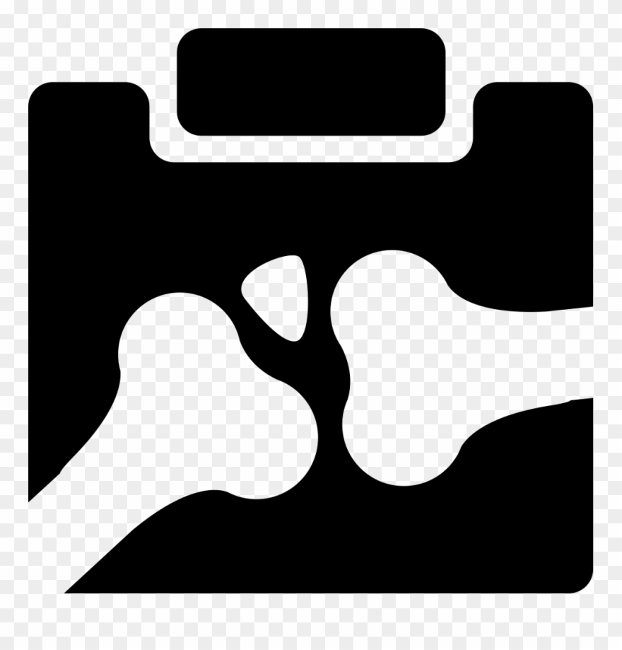 X-ray Of Bones Comments - Iconos De Rayos X Clipart