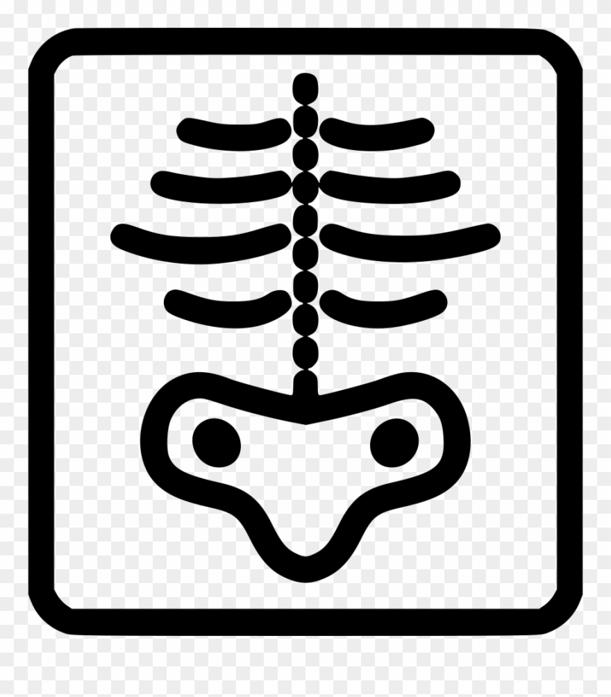 Xray Comments - Рентген Иконка Clipart