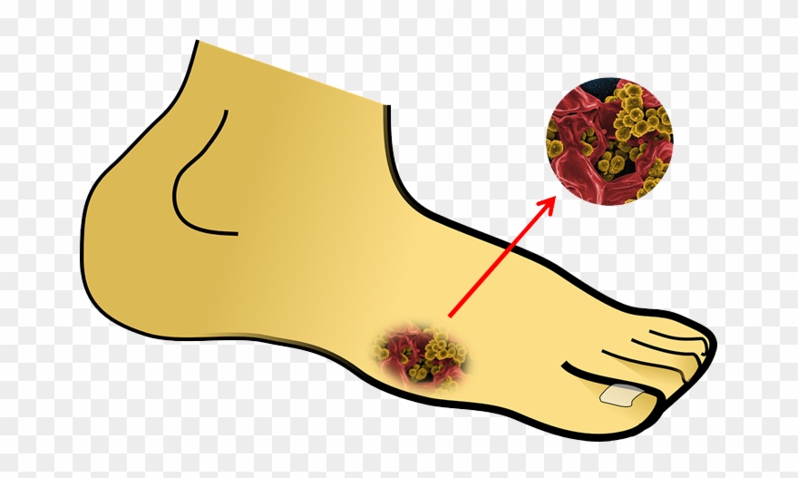 Treatment Clipart