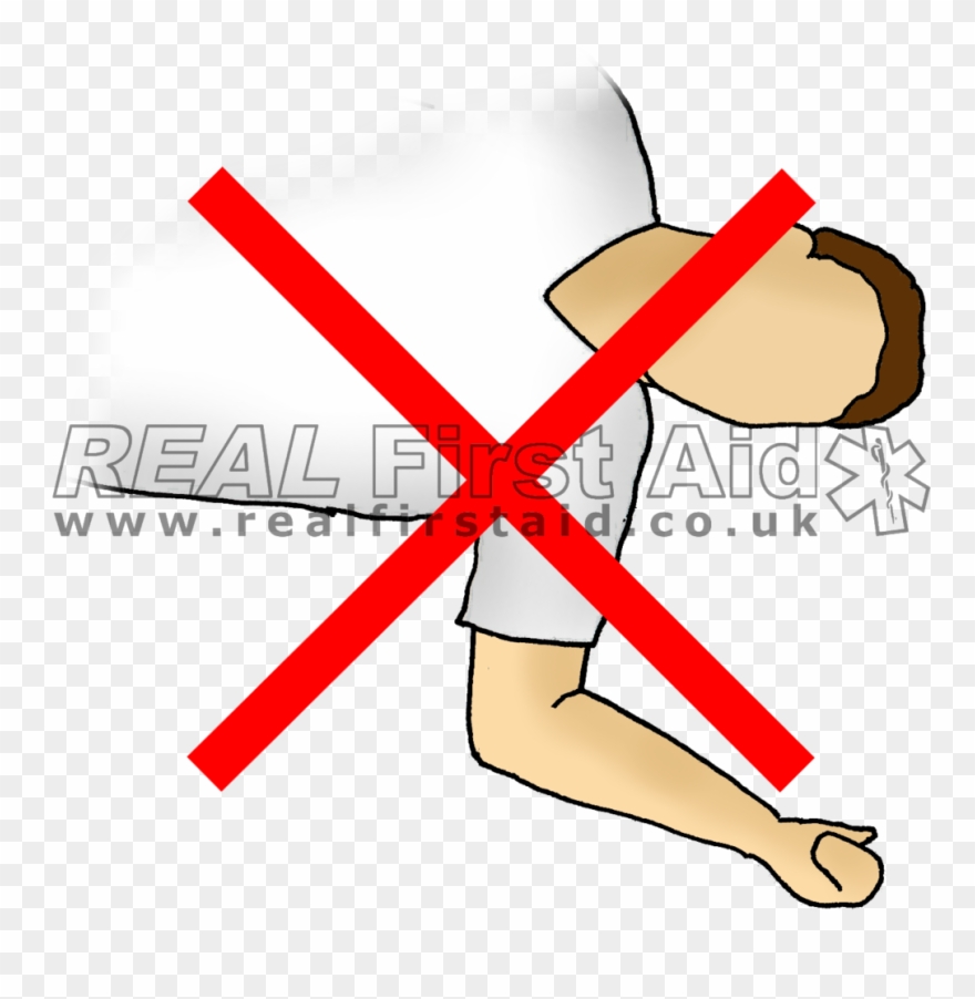 Casualty Positioning Real First Aid Sap Arms - Dada Clipart