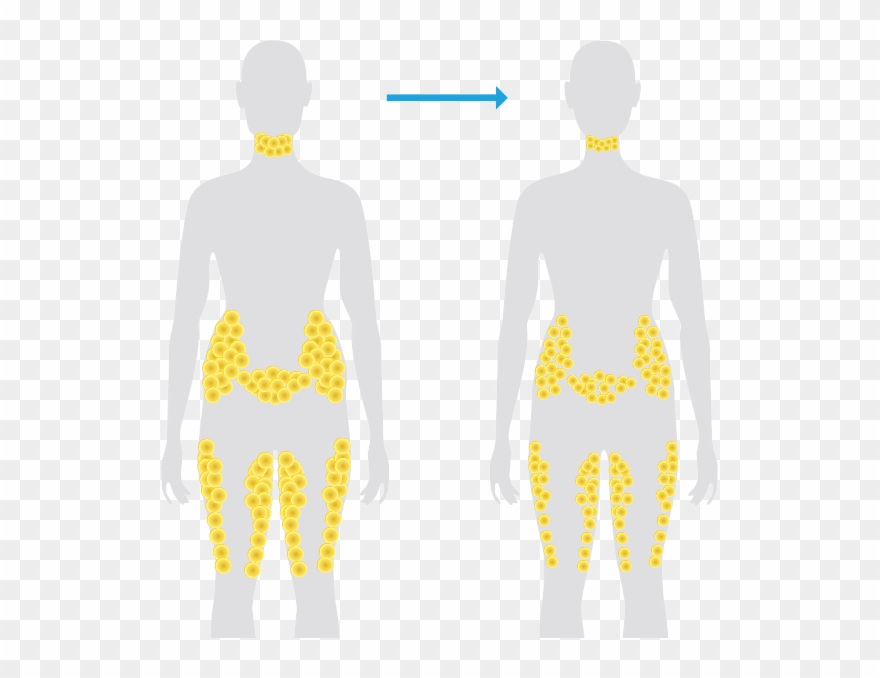 Normal Weight Loss - Fat Cells Are Located Clipart