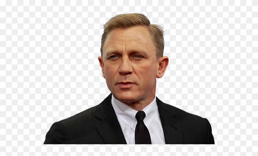 In 2017, Dr Ian Kinane Launched The First Academic - Thinning Hair Men Clipart